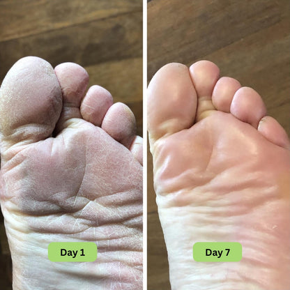 Vanuca™ Tea Tree Oil Antifungal Soap Bar