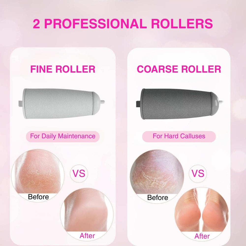 Vanuca™ Silk Pro Electric Callus Remover